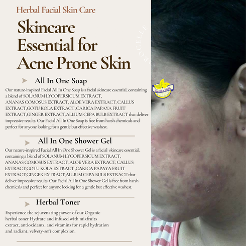 Brown Beige Simple Acne Skincare Essential 11