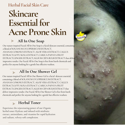 Brown Beige Simple Acne Skincare Essential 8