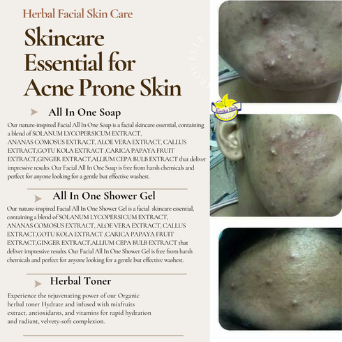 Brown Beige Simple Acne Skincare Essential 9