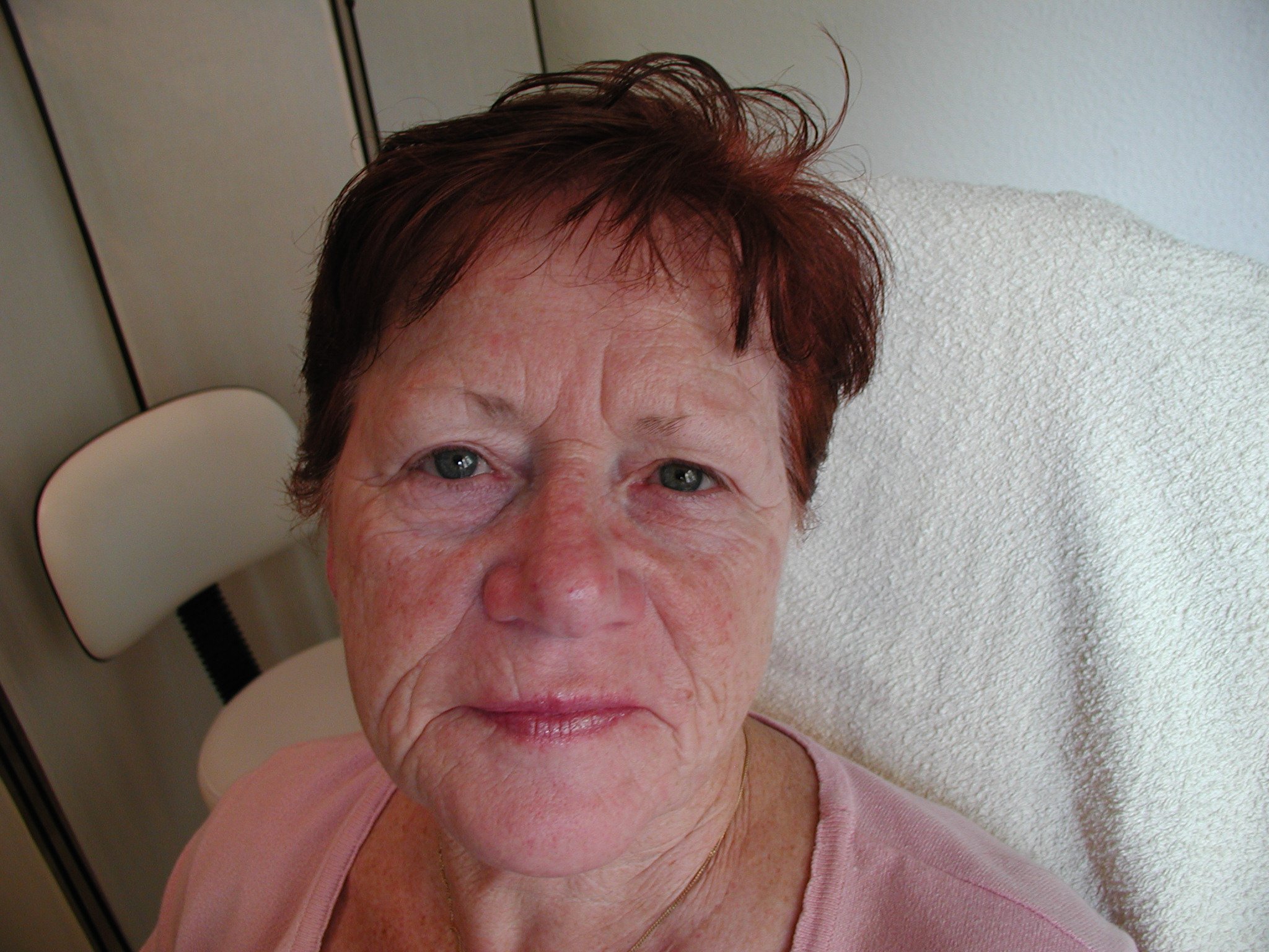 Model 7 Augenbrauen Vorher