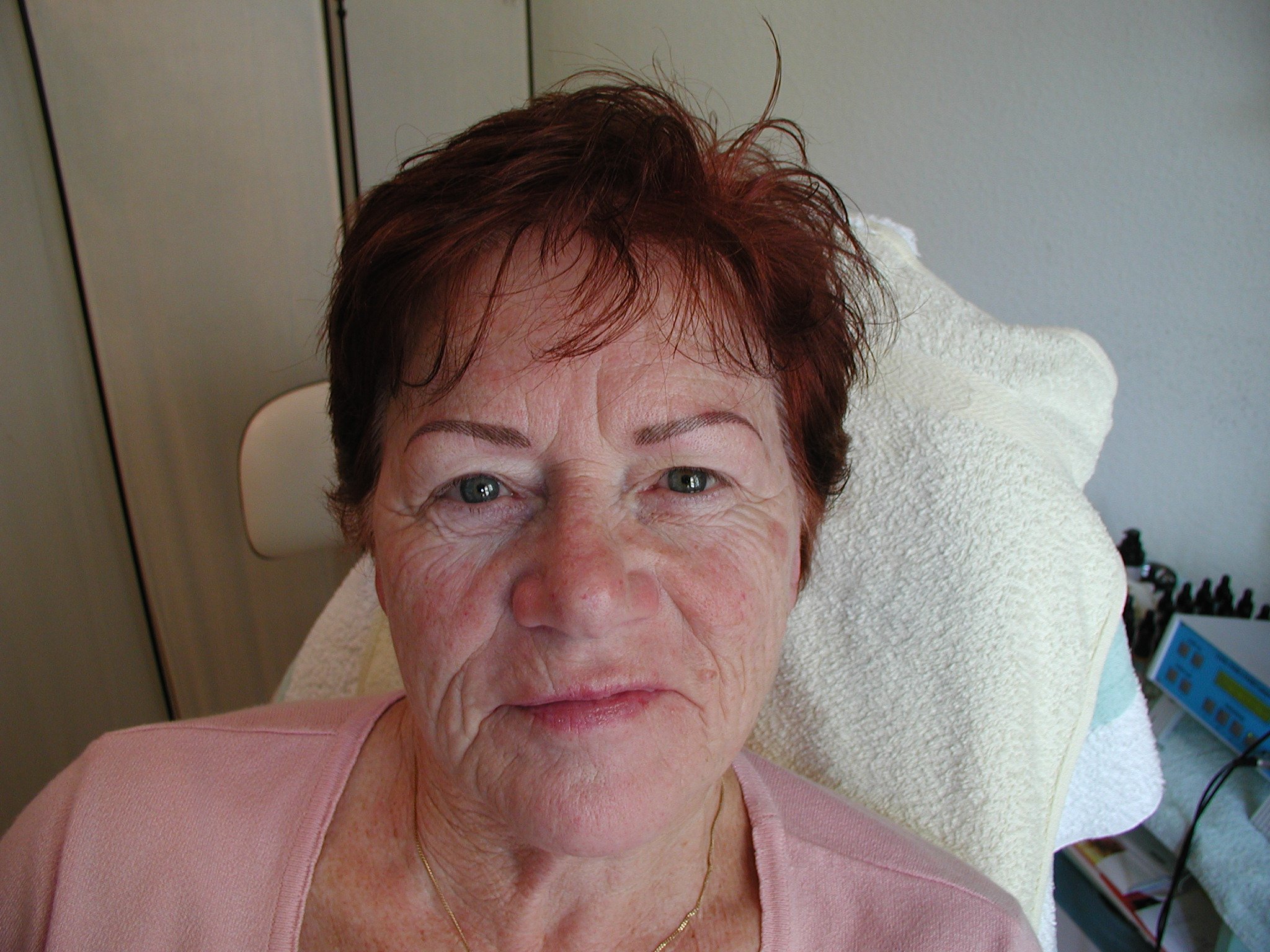 Model 7 Augenbrauen Nachher