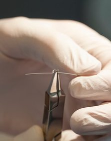 Forberedelse af bøjle til nedgroet negl – præcis håndtering af bøjletråd i fodbehandling. Forberedelse af bøjle til nedgroet negl – præcis håndtering af bøjletråd i fodbehandling.