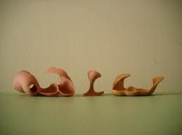 Orthoplasties