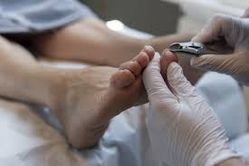 medisch pedicure