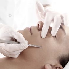 DERMAPLANING