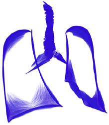 Cirugía Torácica, Thoracic Surgery