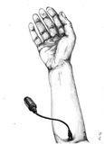 intravenoes (2)