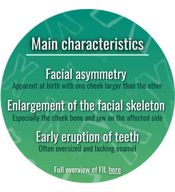 Main features of Facial Infiltrating Lipomatosis