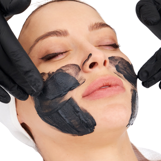 Carbon Peeling