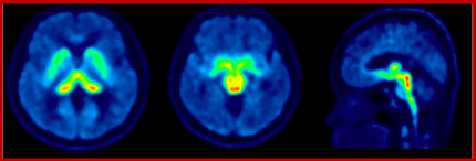 [18F]-FPBM2  : SERT(5HTT) imaging agents
