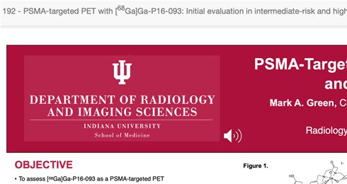 5.Green,M. ,et al. “PSMA-targeted PET with [68Ga] Ga-P16-093: Initial evaluation in intermediate-risk and high-risk prostate cancer patients prior to prostatectomy”. Journal of Nuclear Medicine, 61(supplement 1), （2020）pp.192-192.